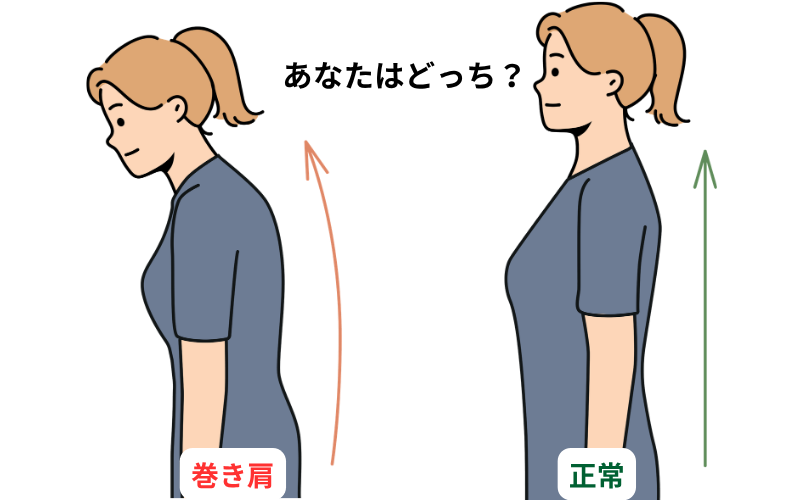 正常な肩の位置と巻き肩の違いを示す比較図